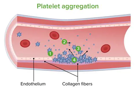 A Study on Platelet Aggregation in ACS Patients