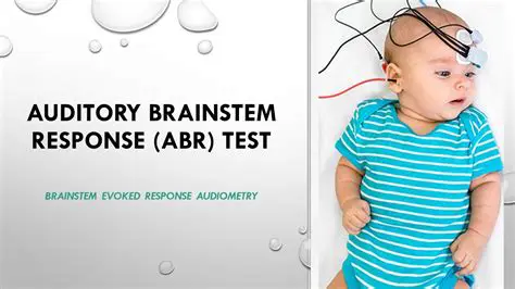 ABR measures electrical activity in the brain stem in response to sound