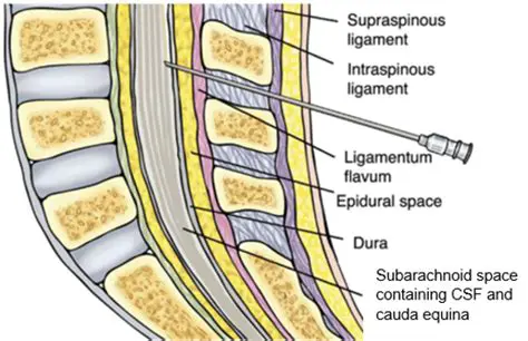 Anatomy of the Intrathecal Space