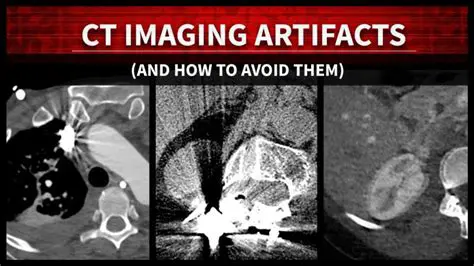 Artifact in CT Scan Images