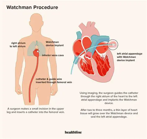 Benefits of Using Watchman