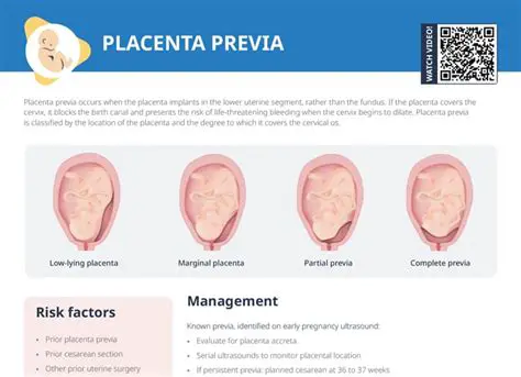 Characteristics of Placenta Previa