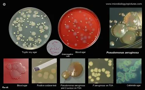 Characteristics of Pseudomonas aeruginosa