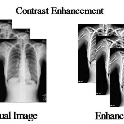 Contrast enhancement technique