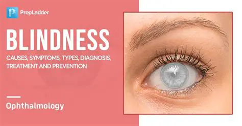 Corneal abnormalities are one of the main causes of blindness