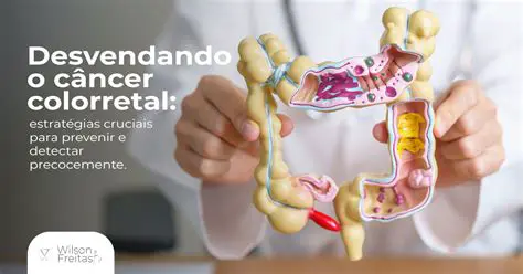 Desvendando 'Wilson': O Guia Completo para Sua Ortografia e Origem