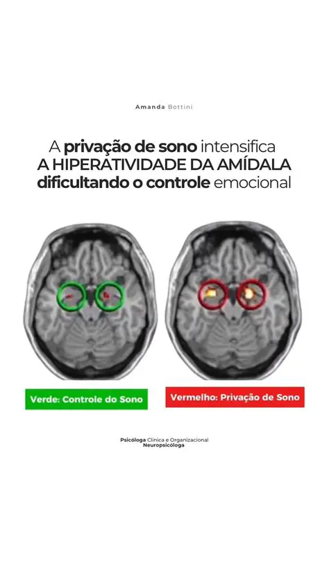 Dificuldade em lidar com o estresse