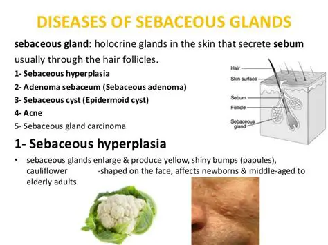 Diseases and Disorders Affecting Sebaceous Glands