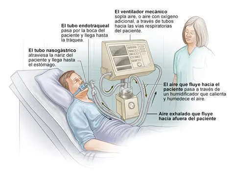 Dispositivos de asistencia respiratoria