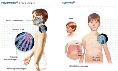 Examples of Idiopathic Conditions