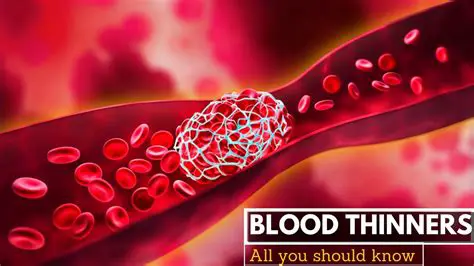 Frequently Asked Questions About Blood Thinners