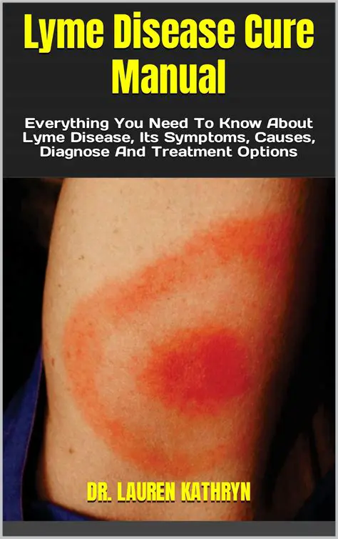Frequently Asked Questions about Lyme Disease