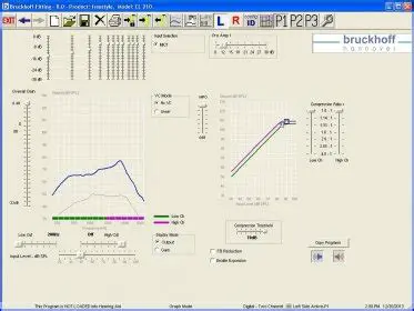 Key Features of the Bruckhoff Fitting System