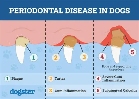 Leading to Periodontal Disease