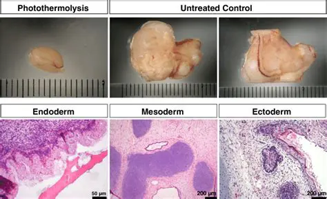Less risk of teratoma formation