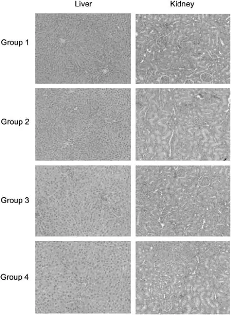 Liver histopathology analysis