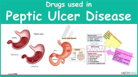 Medications Used to Treat Peptic Ulcer Disease