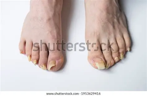 Nails must not be excessively long