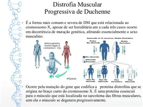 Perguntas e Respostas sobre a Distrofia Muscular Progressiva