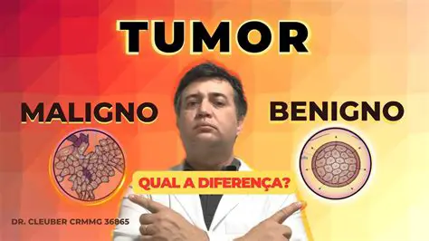 Perguntas e Respostas sobre Tumores Benignos e Malignos