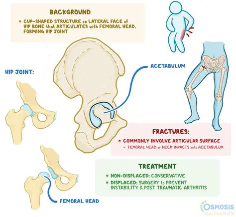 Positioning the Acetabulum Favorably for Femoral Movement