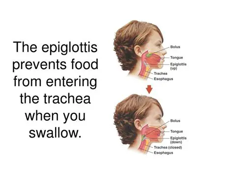 Preventing Food from Entering the Trachea