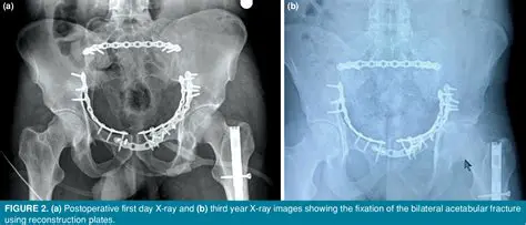 Shorter operation duration