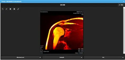 Support for DICOM files with multiple embedded images