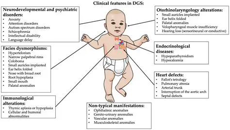 Symptoms of DiGeorge Syndrome