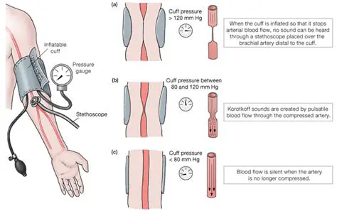 The Impact of Cuff Inflation on Blood Pressure Readings