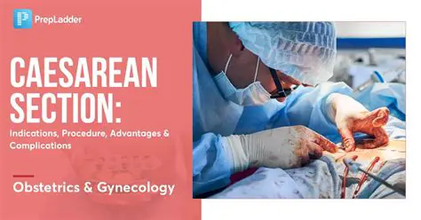 The Importance of Caesarean Operation Agreement
