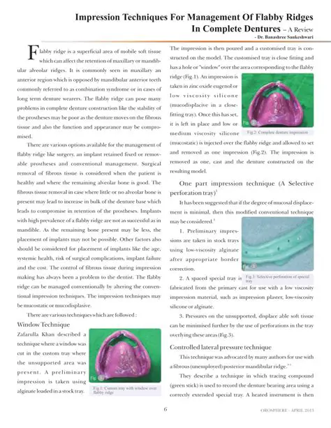 The Importance of Print Techniques in Ridge Flabby