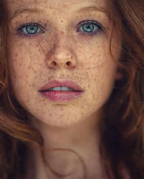 The Link Between Red Hair and Freckles