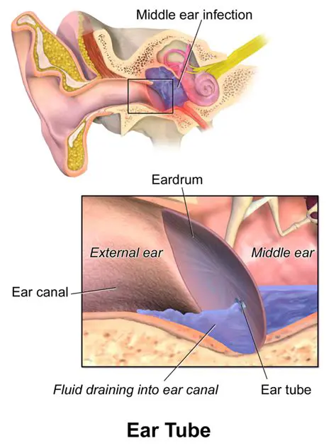 The Part of the Inner Ear Filled with Fluid