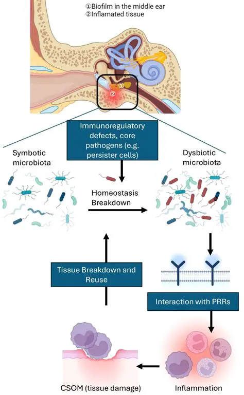 The Role of Allergies in Chronic Suppurative Otitis Media