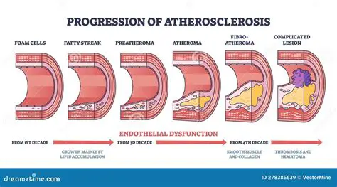 The Role of Inflammation in Atherosclerosis