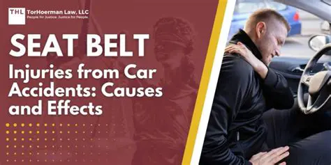 The Role of Seat Belts in Car Accidents