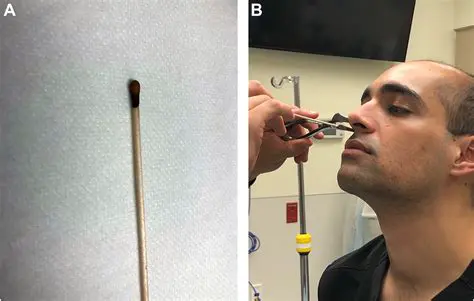 The Septum and Its Role in Epistaxis