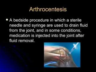 Therapeutic arthrocentesis