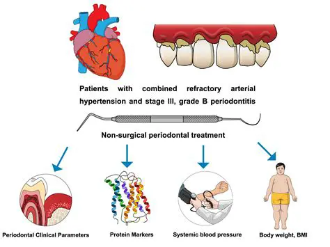 This will provide new alternatives in treatment to improve overall periodontal health
