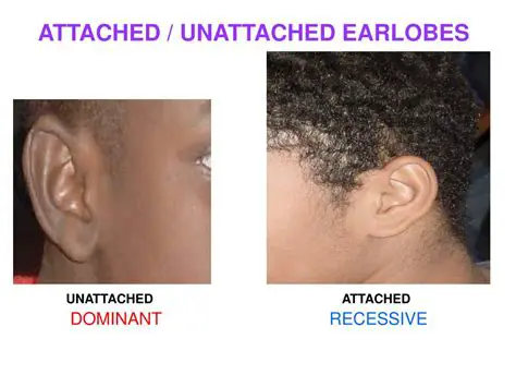 Unattached Earlobes and Cleft Chin