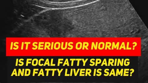 Understanding Focal Fatty Sparing