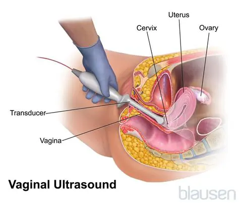 Understanding Gynecologic Diagnostic Tests