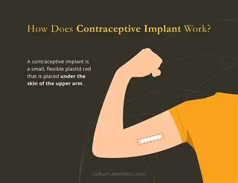 Understanding Implant Contraception and Its Importance