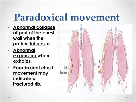 Understanding Paradoxical Chest Wall Movement