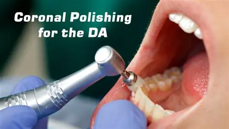 Understanding the Importance of Coronal Polishing