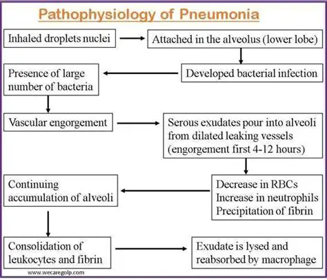Understanding the Importance of Nutrition in Pneumonia Recovery