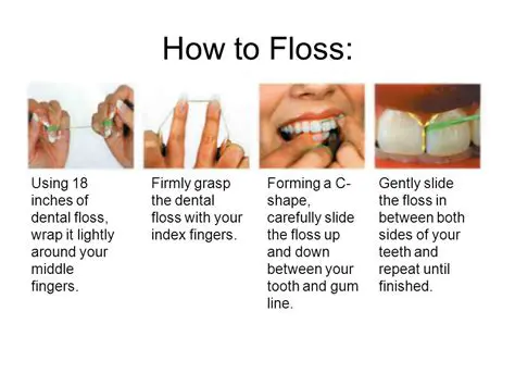 Understanding the Relationship Between Flossing Habits and Gum Disease