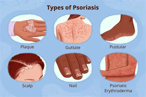 Unraveling Psoriasiform Plaques: Causes, Symptoms, and Comprehensive Management