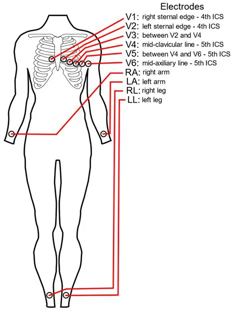 Variations in Electrode Distance and Contact Time